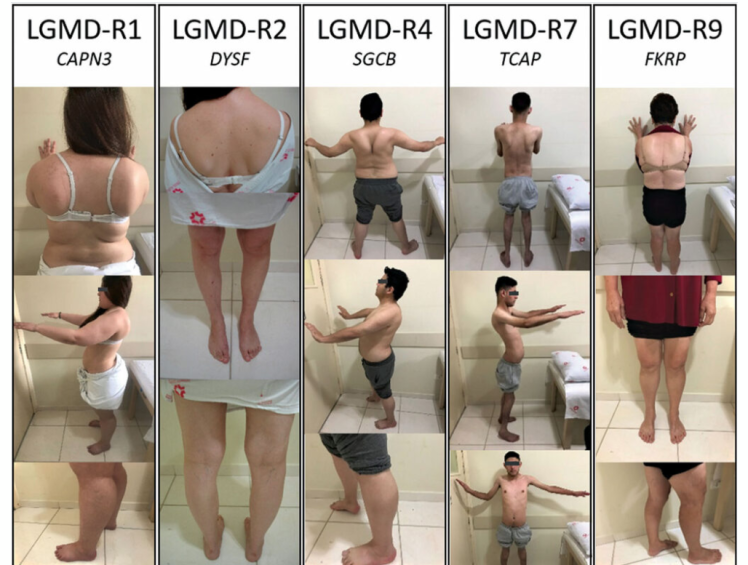 Some Terms You May Encounter When Reading Neuromuscular Research Articles - Part 2