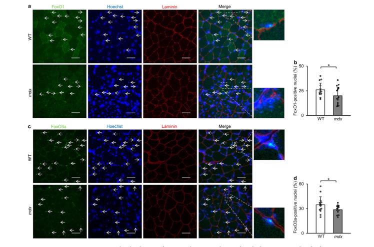 Transcriptional dysregulation of autophagy in the muscle of a mouse model of Duchenne muscular dystrophy