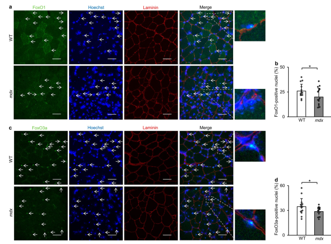 Transcriptional dysregulation of autophagy in the muscle of a mouse model of Duchenne muscular dystrophy